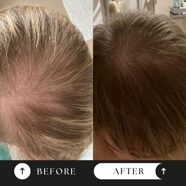 Balance Hairgrowth Activator